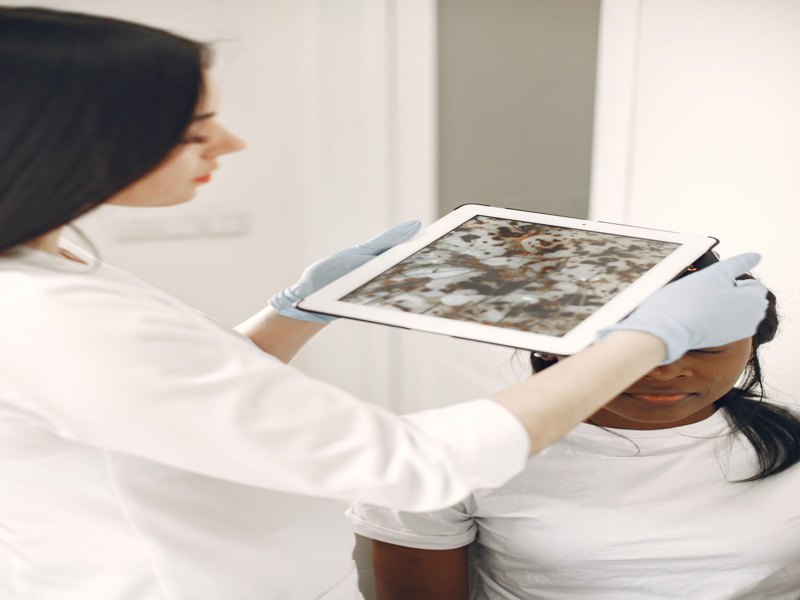 Skin Cancer Check by Dr.Thor