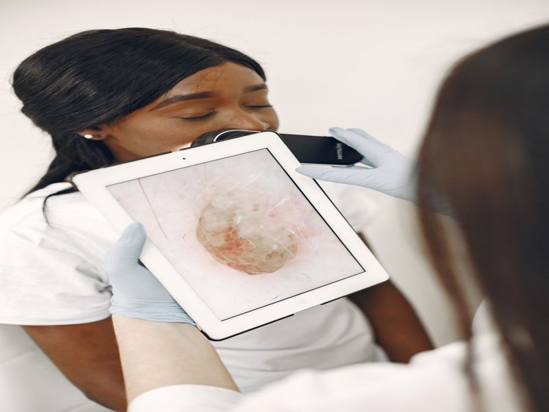 Skin Cancer Check by Dr.Thor