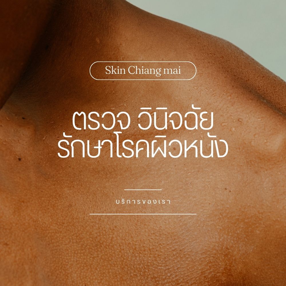 Skin Cancer Check by Dr.Thor