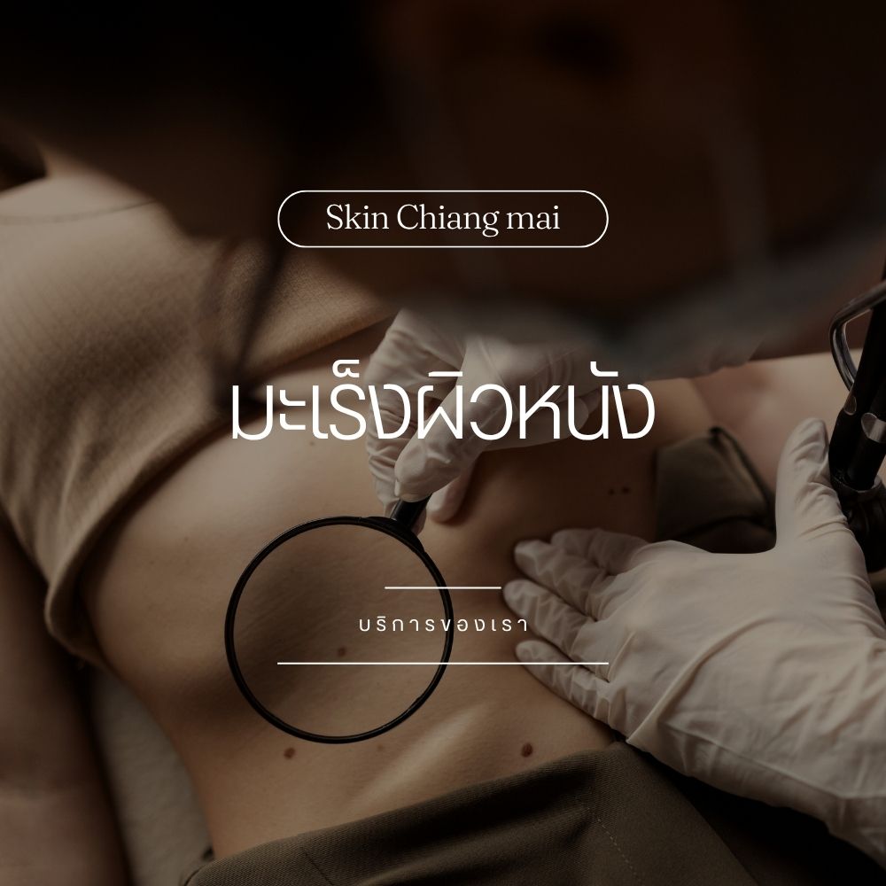 Skin Cancer Check by Dr.Thor
